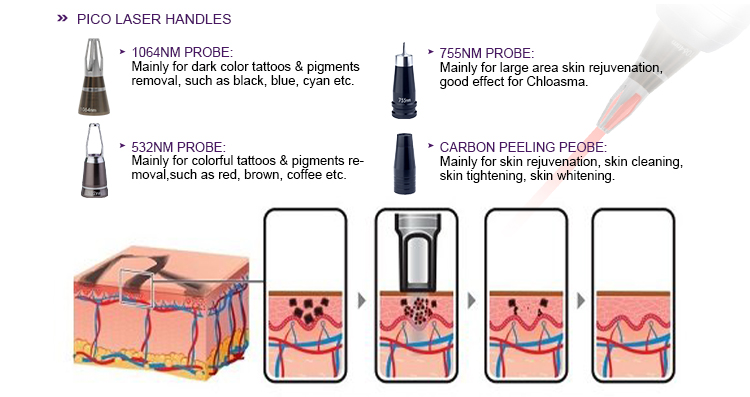IPL RF E-Light YAG Laser Beauty Equipment US0020H