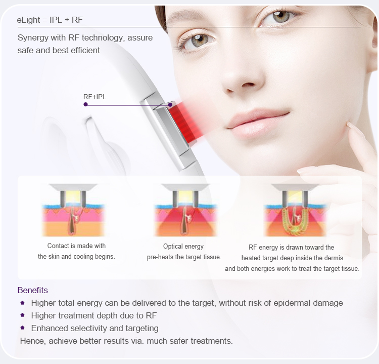 IPL Hair Removal Dpl Skin Care Beauty Machine US0030F