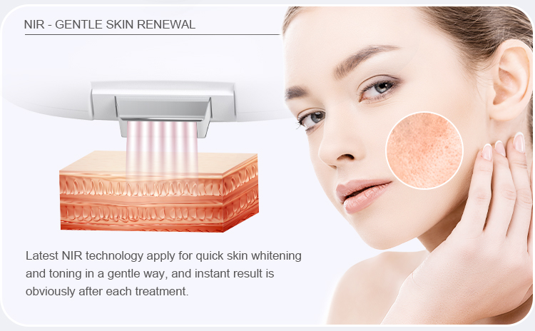 IPL Optional Skin Care Machine US6120F