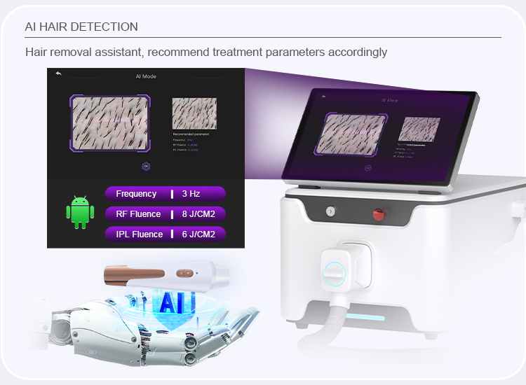 IPL Optional Skin Care Machine US6120F