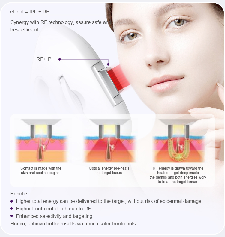 IPL Optional Skin Care Machine US6120F