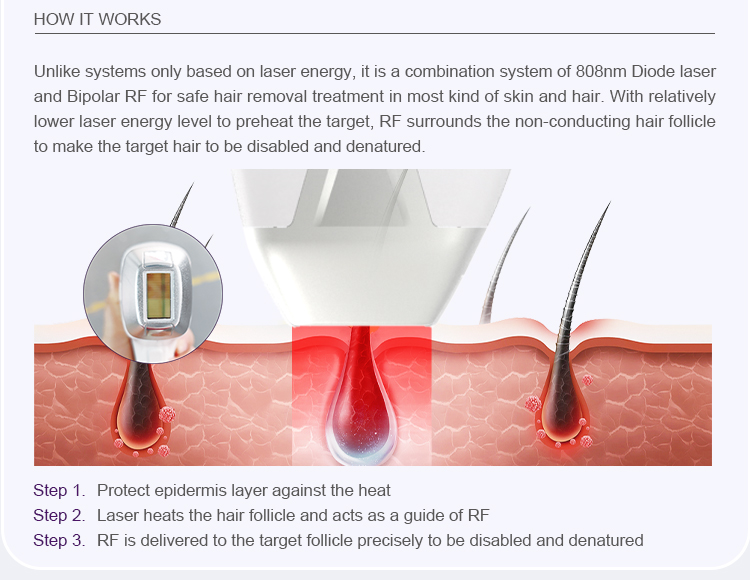 Big Spot Size Hair Removal Machine US4610