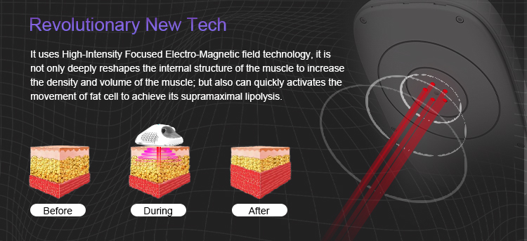 Electromagnetic Teslasculpt Hi-EMT Slim Machine US3800F