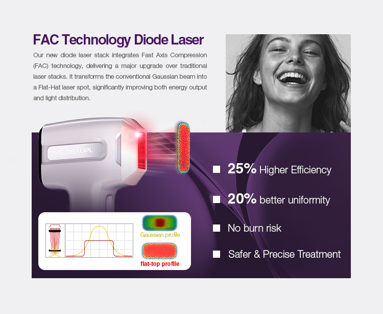 755 808 1064nm Diode Laser Hair Removal Machine US4500