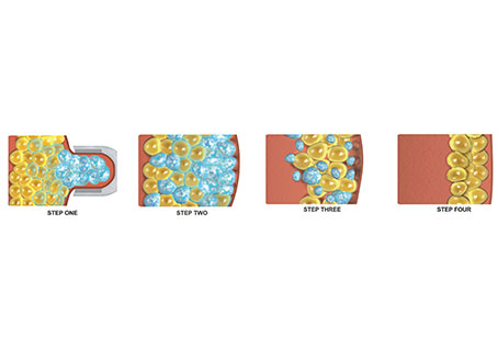 Cryopreservation technique