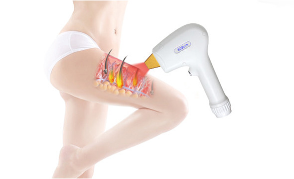 Diode Laser Hair Removal Machine