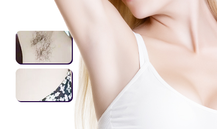 Armpit Hair Removal