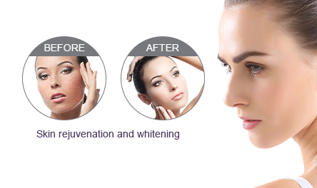 Skin Rejuvenation and Whitening